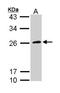 Glycoprotein Ib Platelet Subunit Beta antibody, NBP1-33169, Novus Biologicals, Western Blot image 