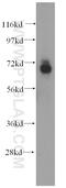 ADAMTS-like protein 4 antibody, 15304-1-AP, Proteintech Group, Western Blot image 