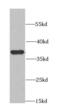 Cyclin Dependent Kinase 6 antibody, FNab01562, FineTest, Western Blot image 