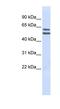 Phosphatidylinositol Glycan Anchor Biosynthesis Class Q antibody, NBP1-59740, Novus Biologicals, Western Blot image 