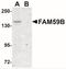 GRB2 Associated Regulator Of MAPK1 Subtype 2 antibody, NBP2-41118, Novus Biologicals, Western Blot image 
