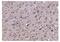 Translocase Of Inner Mitochondrial Membrane 8A antibody, A07659-1, Boster Biological Technology, Immunohistochemistry paraffin image 