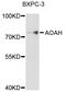 Acyloxyacyl Hydrolase antibody, abx125520, Abbexa, Western Blot image 