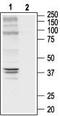 Opioid Receptor Delta 1 antibody, TA328921, Origene, Western Blot image 