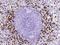 S100A8 antibody, 11138-R216, Sino Biological, Immunohistochemistry paraffin image 