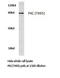 PKC antibody, LS-C176455, Lifespan Biosciences, Western Blot image 