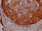 APC Regulator Of WNT Signaling Pathway antibody, CSB-RA951649A0HU, Cusabio, Immunohistochemistry paraffin image 
