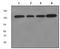 Receptor Tyrosine Kinase Like Orphan Receptor 2 antibody, TA307281, Origene, Western Blot image 