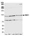 ER Membrane Protein Complex Subunit 1 antibody, A305-605A-M, Bethyl Labs, Western Blot image 