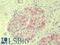 Vasohibin 1 antibody, LS-B9515, Lifespan Biosciences, Immunohistochemistry frozen image 