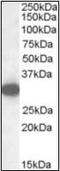 Monoglyceride Lipase antibody, orb89644, Biorbyt, Western Blot image 