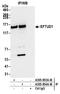 Elongation Factor Like GTPase 1 antibody, A305-853A-M, Bethyl Labs, Immunoprecipitation image 