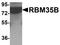 RBM35B antibody, NBP1-76537, Novus Biologicals, Western Blot image 