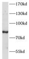 Ankyrin repeat domain-containing protein 6 antibody, FNab00420, FineTest, Western Blot image 