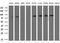 Phenylalanyl-tRNA synthetase beta chain antibody, M11656, Boster Biological Technology, Western Blot image 