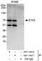EYA Transcriptional Coactivator And Phosphatase 2 antibody, NBP1-46816, Novus Biologicals, Immunoprecipitation image 