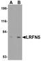 Leucine Rich Repeat And Fibronectin Type III Domain Containing 5 antibody, NBP1-77004, Novus Biologicals, Western Blot image 
