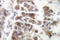 GATA Binding Protein 4 antibody, LS-C176597, Lifespan Biosciences, Immunohistochemistry paraffin image 