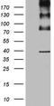 ALK Receptor Tyrosine Kinase antibody, TA801115S, Origene, Western Blot image 