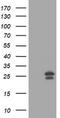 O-6-Methylguanine-DNA Methyltransferase antibody, CF800745, Origene, Western Blot image 
