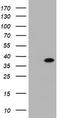 Kinesin Family Member 25 antibody, CF505433, Origene, Western Blot image 