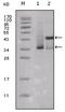 Estrogen Receptor 1 antibody, AM06229SU-N, Origene, Western Blot image 