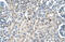 Serine Hydroxymethyltransferase 2 antibody, ARP46129_P050, Aviva Systems Biology, Immunohistochemistry paraffin image 