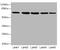 IlvB Acetolactate Synthase Like antibody, CSB-PA011687LA01HU, Cusabio, Western Blot image 