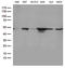 DExD-Box Helicase 39B antibody, LS-C796421, Lifespan Biosciences, Western Blot image 