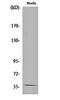 Potassium Voltage-Gated Channel Subfamily A Member 1 antibody, orb161572, Biorbyt, Western Blot image 