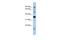 Proline Rich 19 antibody, A18017, Boster Biological Technology, Western Blot image 