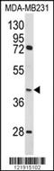 Homer Scaffold Protein 3 antibody, PA5-72511, Invitrogen Antibodies, Western Blot image 