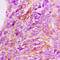 Interleukin 13 Receptor Subunit Alpha 1 antibody, LS-C359028, Lifespan Biosciences, Immunohistochemistry paraffin image 