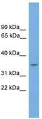 MEF2 Activating Motif And SAP Domain Containing Transcriptional Regulator antibody, TA333390, Origene, Western Blot image 