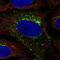 Secretory Carrier Membrane Protein 3 antibody, NBP2-56966, Novus Biologicals, Immunofluorescence image 