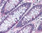 Metastasis suppressor protein 1 antibody, TA317043, Origene, Immunohistochemistry paraffin image 