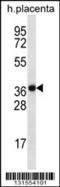 Solute Carrier Family 38 Member 8 antibody, 56-586, ProSci, Western Blot image 