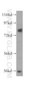 Mdm1 Nuclear Protein antibody, 17575-1-AP, Proteintech Group, Western Blot image 