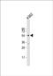 Hyaluronidase 4 antibody, PA5-48622, Invitrogen Antibodies, Western Blot image 