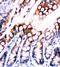 Fatty Acid Binding Protein 5 antibody, LS-C312991, Lifespan Biosciences, Immunohistochemistry frozen image 