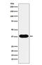 CD79b Molecule antibody, M01399, Boster Biological Technology, Western Blot image 