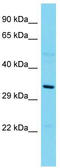 E2F Associated Phosphoprotein antibody, TA344860, Origene, Western Blot image 