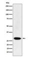 MAX Dimerization Protein 3 antibody, M11285, Boster Biological Technology, Western Blot image 