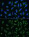 Apolipoprotein B-100 antibody, GTX64377, GeneTex, Immunocytochemistry image 