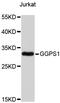 Geranylgeranyl Diphosphate Synthase 1 antibody, STJ23779, St John