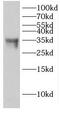 ETS Homologous Factor antibody, FNab02678, FineTest, Western Blot image 