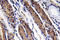 Pepsin A antibody, LS-C291724, Lifespan Biosciences, Immunohistochemistry paraffin image 
