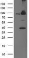 Proteasome 26S Subunit, Non-ATPase 2 antibody, TA503198, Origene, Western Blot image 