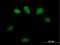 Glutathione S-Transferase Omega 2 antibody, H00119391-B01P, Novus Biologicals, Immunocytochemistry image 