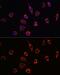 Presenilin 1 antibody, GTX55757, GeneTex, Immunofluorescence image 